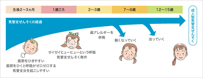小児喘息