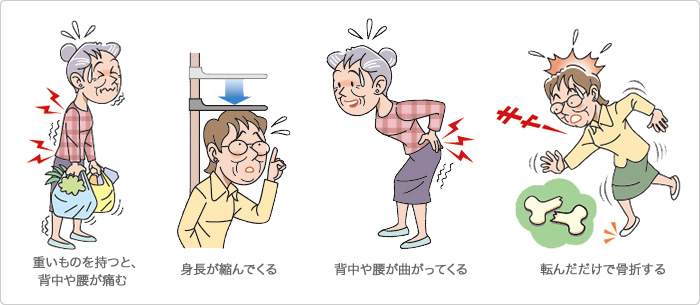 症状は？ ONO MEDICAL NAVI 一般・患者さん向け 小野薬品