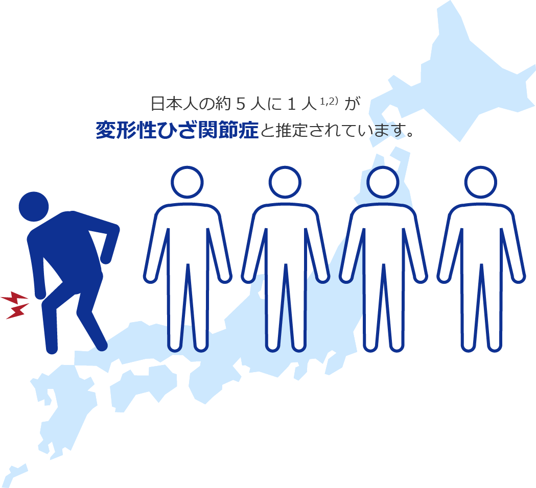 日本人の約5人に1人が変形性ひざ関節症と推定されています。
