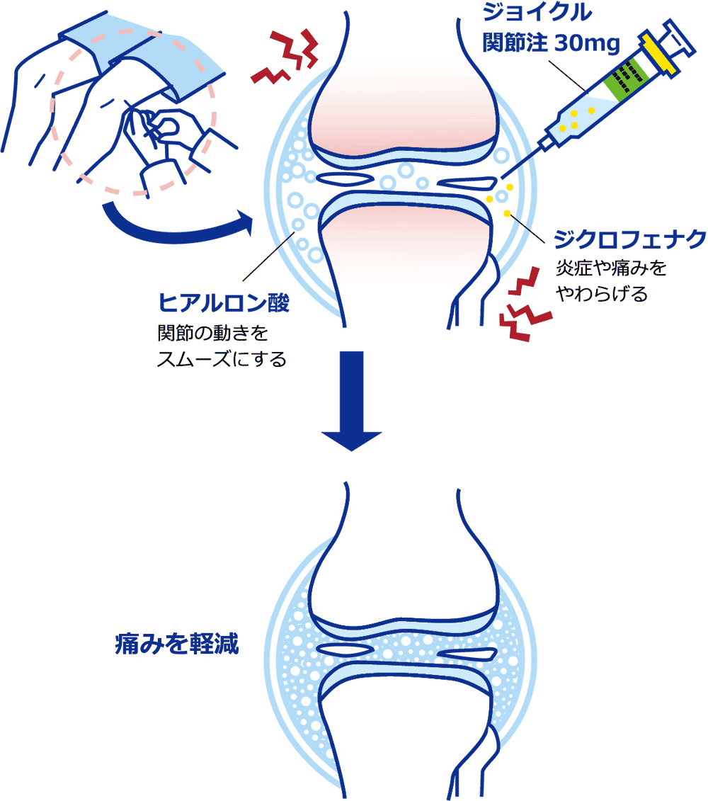 痛みを軽減